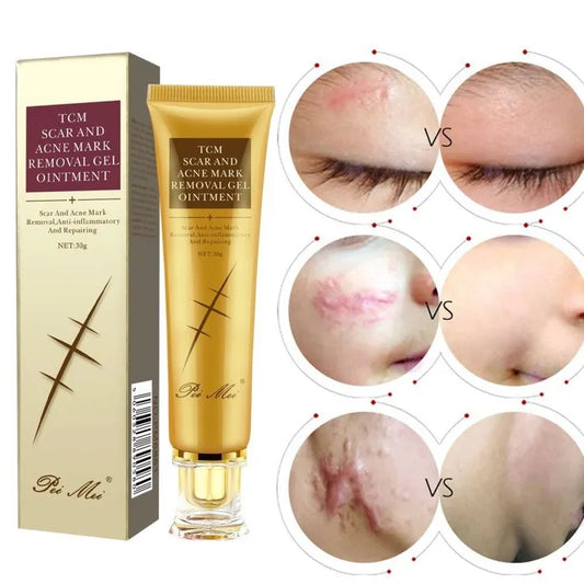 ✨ Crème Réparatrice Anti-Cicatrices & Acné – TCM Gel Naturel