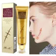 ✨ Crème Réparatrice Anti-Cicatrices & Acné – TCM Gel Naturel