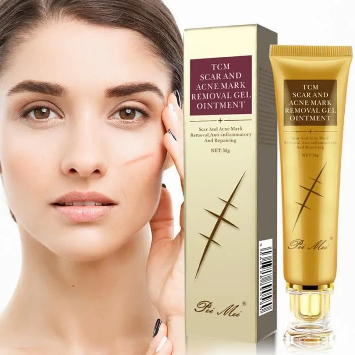 ✨ Crème Réparatrice Anti-Cicatrices & Acné – TCM Gel Naturel